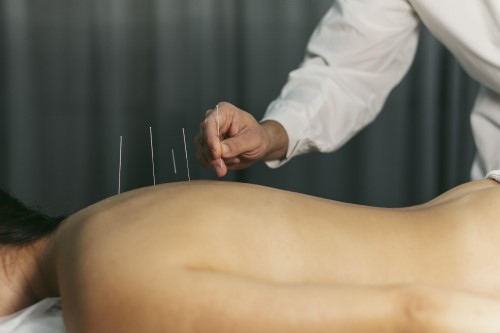 Hoe helpt acupunctuur bij gewichtsverlies